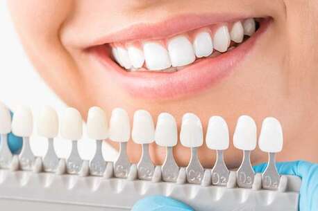 Miami, Health, Miami Cosmetic Dentistry For Professional Teeth Whitening