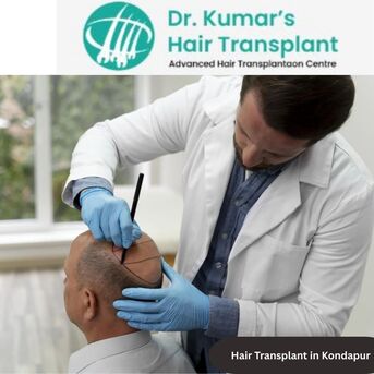 Hyderabad, Health, A Complete Guide To Hair Transplant Clinics In Kondapur