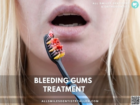 Dallas, Dental, Bleeding Gums Treatment In Allen, TX