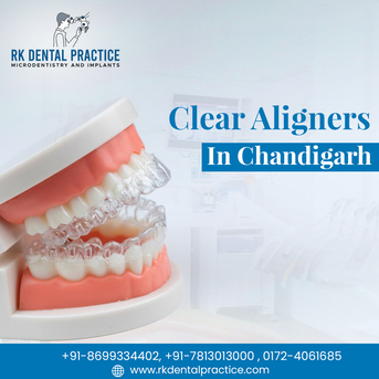 Chandigarh, Dental, Clear Aligners In Chandigarh For Invisible Teeth Straightening