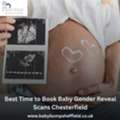 Best Time To Book Baby Gender Reveal Scans Chesterfield