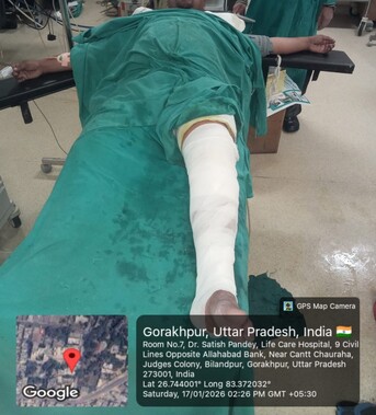 Lucknow, Health, Best Knee Replacement Specialist Under Ayushman Bharat Yojana