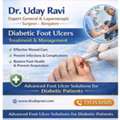 Diabetic Foot Ulcers Treatment & Management - Dr. Uday Ravi.