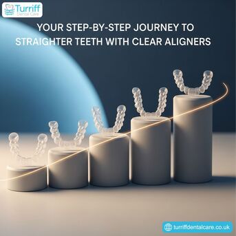 London, Dental, Your Step-by-Step Journey To Straighter Teeth With Clear Aligners