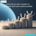 Your Step-by-Step Journey To Straighter Teeth With Clear Aligners