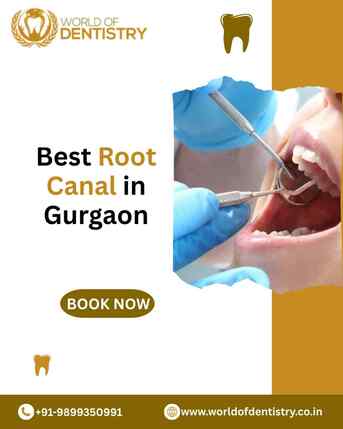 Gurgaon, Dental, Best Root Canal In Gurgaon