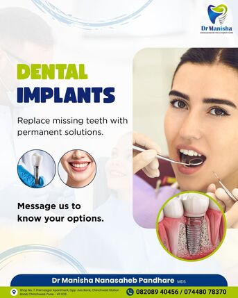 Pune, Health, Best Dentist In Chinchwad | Root Canal, Braces & Dental Implants  Dr.Manisha Pandhare