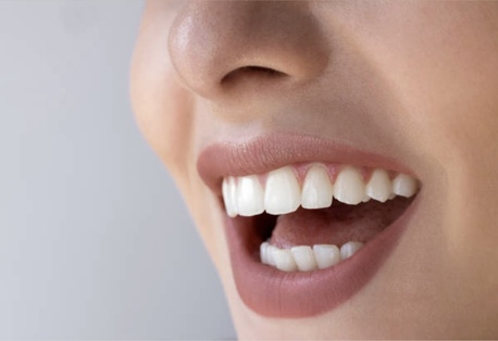 Auckland, Health, Tooth Color Fillings In Auckland