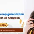 Advanced Scalp Micropigmentation In Gurgaon - SB Trichology