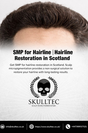 London, Business, SMP For Hairline Restoration In Scotland | Natural Hairline Solutions