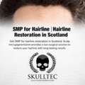 SMP For Hairline Restoration In Scotland | Natural Hairline Solutions