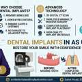 BEST DENTAL IMPLANTS IN AS RAO NAGAR &ndash; PERMANENT TOOTH REPLACEMENT