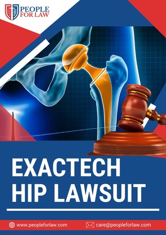 New York, Legal, Exactech Hip Lawsuit In Winter Park - People For Law