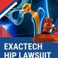 Exactech Hip Lawsuit In Winter Park - People For Law