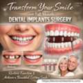 Transform Your Smile With Full Mouth Dental Implants Surgery