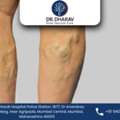 Minimally Invasive Vein Disorder Treatment In India By Dr. Dharav Kheradia