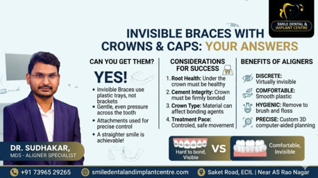 Hyderabad, Dental, CAN I GET INVISIBLE BRACES WITH CROWNS? YES! FIND OUT HOW