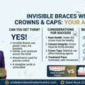 CAN I GET INVISIBLE BRACES WITH CROWNS? YES! FIND OUT HOW