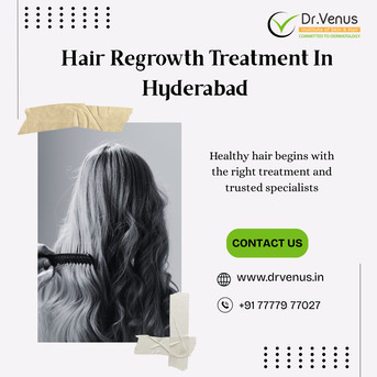 Kurnool, Health, Hair Regrowth Treatment In Hyderabad | Dr. Venus