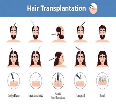 Pune, Health, Hair Transplant Clinic In Pune | Natural Results At Arnica Clinic