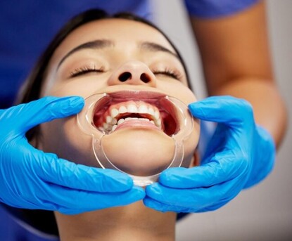 Sydney, Business, Are You Looking For Expert Bite Correction Service Murwillumbah?