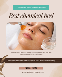 Houston, Business, Best Chemical Peel Houston