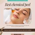 Best Chemical Peel Houston