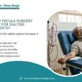 AV Fistula Doctor Indore For Safe Dialysis Access