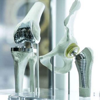 Ahmedabad, Health, Trusted Revision Knee, Hip & Shoulder Replacement