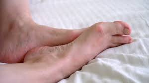 Singapore, Health, Taming The Pain: A Deeper Look Into Bunion Care Services