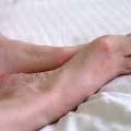 Taming The Pain: A Deeper Look Into Bunion Care Services
