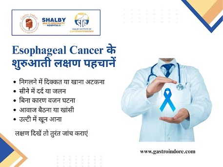Indore, Health, Best GI Cancer Doctor In Indore For Digestive Cancer Care