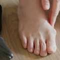 The Informative Manual To Bunion Surgery