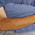 Dry Needling Near Me &ndash; Reduce Pain & Muscle Tension | Strength Clinic