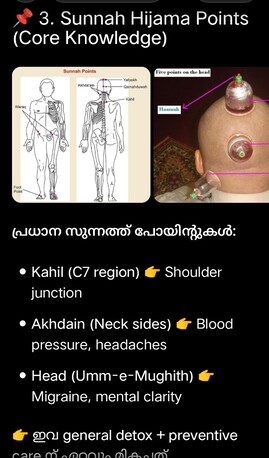 Kerala, Health, Hijama (Cupping )Therapy  Home Service.