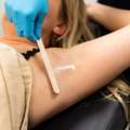 Laser Hair Removal In Fort Collins CO Smooth Lasting Results