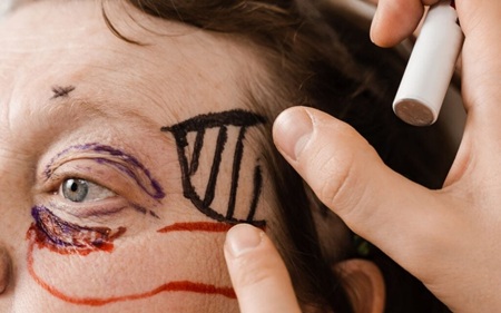 New York, Medical, Plastic & Cosmetic Surgery &ndash; East West Eye Institute