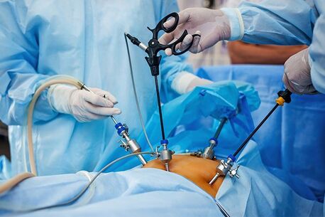New Delhi, Health, Laparoscopic Surgeon In Delhi