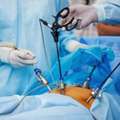 Laparoscopic Surgeon In Delhi