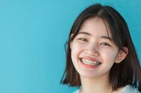 Singapore, Dental, Navigating Orthodontics: Braces In Singapore
