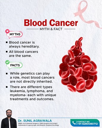 Bhubaneswar, Health, Blood Cancer Myths & Facts | Best Oncologist In Bhubaneswar &ndash; Dr. Sunil Agrawala.