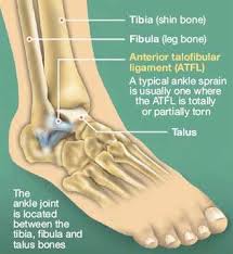 Singapore, Health, 4 Advantages Of Ankle Ligament Tear