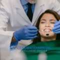 When Should You Replace Dental Fillings?