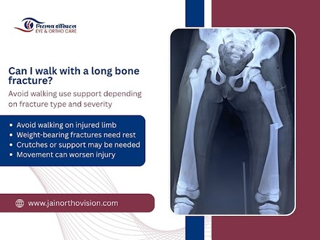 Jaipur, Health, Best Orthopedic Care For Leg Fracture Near You