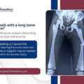Best Orthopedic Care For Leg Fracture Near You