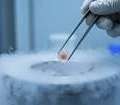 Egg Freezing Success Rate India - CureSpots
