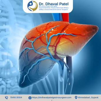 Ahmedabad, Health, Expert Liver & Bile Duct Cancer Surgery By Dr. Dhaval Patel