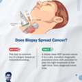 Does Biopsy Spread Cancer? | Best Cancer Surgeon In Bhubaneswar | Dr. Srigopal Mohanty.