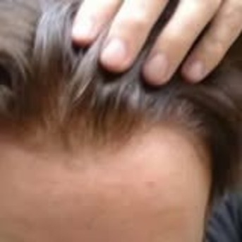 New York, Health & Beauty Items, Best Custom Hair Replacement Systems For Hair Loss Solutions