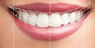 Mississauga, Dental, Smile Makeover Mississauga Book Your Visit Today